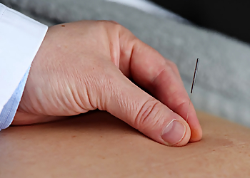 Markham acupuncture Blue Tortoise Acupuncture