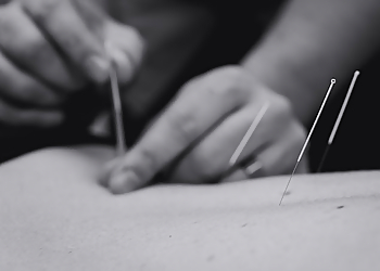 Broddick Clinic Brantford - Brantford, ON Acupuncture - Medical Procedure Image