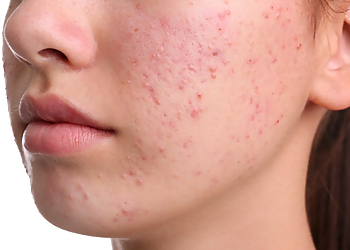 Canada MedLaser Whitby - Whitby, ON Med Spas - Patient Care Image