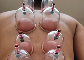 Stouffville massage therapy Topcare Acupuncture & Wellness Centre