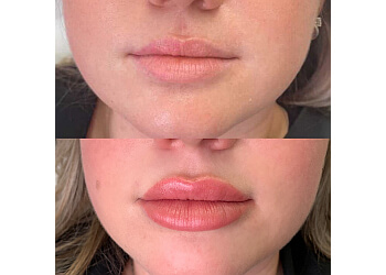 Saint Jean sur Richelieu med spa Clinique Isogone Médico-Esthétique