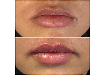 Saint Hyacinthe med spa Clinique bē