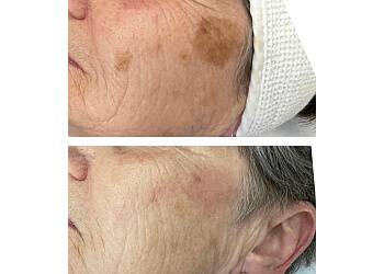 Coquitlam med spa Coquitlam Medical Laser & Skincare Clinic