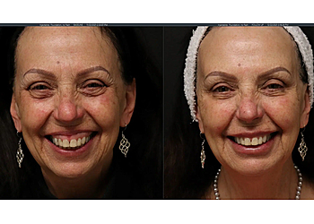 Saanich med spa Derma Spa Uptown