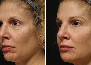 Victoria med spa Derma Spa Victoria