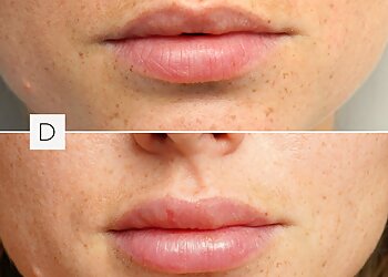 Sherbrooke med spa  Dermapure Sherbrooke