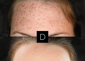 Sherbrooke med spa  Dermapure Sherbrooke