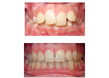 Stouffville orthodontist Dr. Bennett Mui - BRACES IN MARKHAM