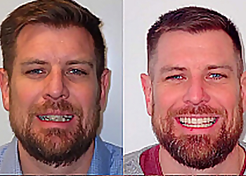 Dr. Kris Currie - ARC ORTHODONTICS - Saskatoon, SK Orthodontistes - Braces Treatment Image