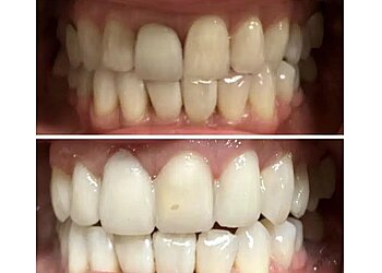 Montreal Dentistes Cosmétiques Dr. Lenny Slepchik - MONTREAL GENERAL DENTISTRY