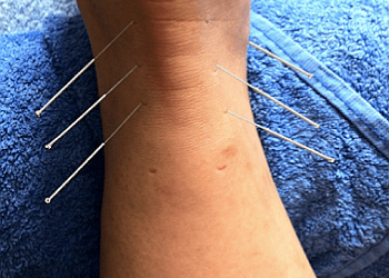 Saint Hyacinthe acupuncture Elisabeth Delmas Acupuncteure