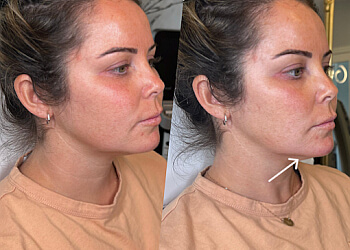 Belleville med spa Forever Youth Aesthetics Inc.