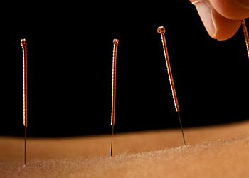 Medicine Hat acupuncture Green Tree Wellness Centres