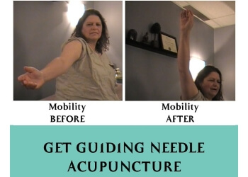 St Albert acupuncture Guiding Needle Acupuncture