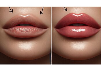 Longueuil med spa Innova Medic