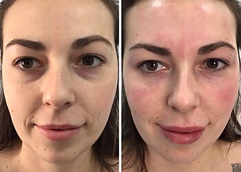 Longueuil med spa Innova Medic