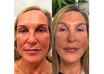 Sault Ste Marie Spa Médical Jenesis Medical Aesthetics