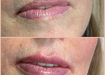 Welland med spa KANE SKIN