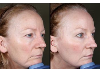 Victoria med spa MD ESTHETICS