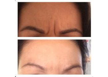 Thunder Bay med spa North Shore Laser Clinic