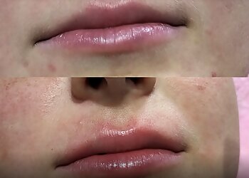 Oshawa med spa On The Spot Beauty Bar