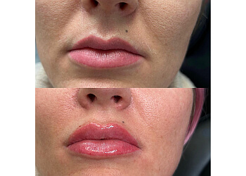 Peterborough med spa Precision Medical Aesthetics