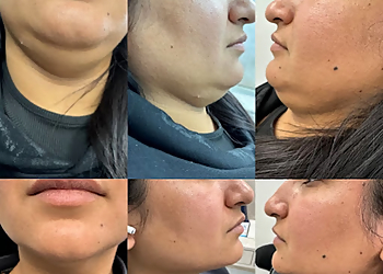 Platinum Medical Spa - Edmonton, AB Spa Médical - Before and After Image