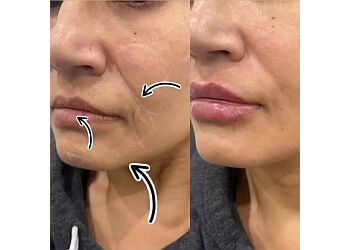 New Westminster naturopathy clinic Polo Health + Longevity Centre