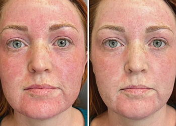 Stratford med spa Refresh Renew Lounge