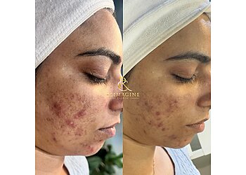 Montreal med spa Reimagine Clinic