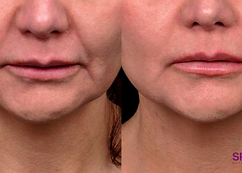 Langley med spa Spa Tru Clinics