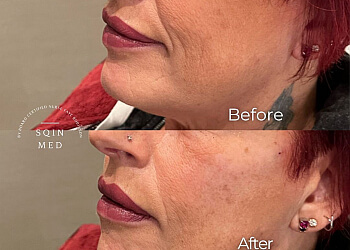 Niagara Falls med spa Sqin Med