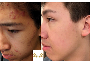 St Albert med spa The Lounge Medical Spa