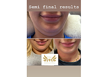 St Albert med spa The Lounge Medical Spa