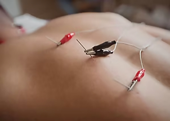 St Johns acupuncture Tiffany Brien R.Ac, Dipl. A.c. n.d.