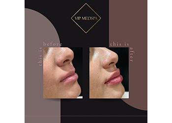 Halton Hills med spa VIP Medspa