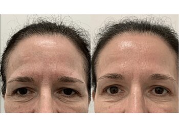 Longueuil med spa Victoria Park Medispa