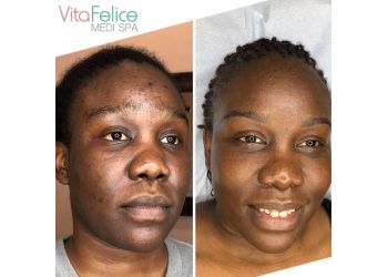 New Westminster med spa Vita Felice Medi Spa